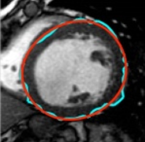 Automatic Image-Driven Segmentation of Left Ventricle in Cardiac Cine MRI