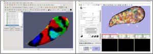 Enabling ITK-based processing and 3D Slicer MRML scene management in ParaView