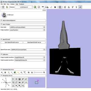 Implementation of the PLUS open-source toolkit for translational research of ultrasound-guided intervention systems