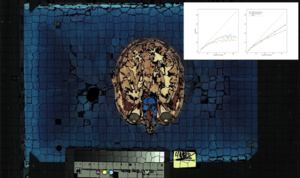 Scalable Simple Linear Iterative Clustering (SSLIC) Using a Generic and Parallel Approach